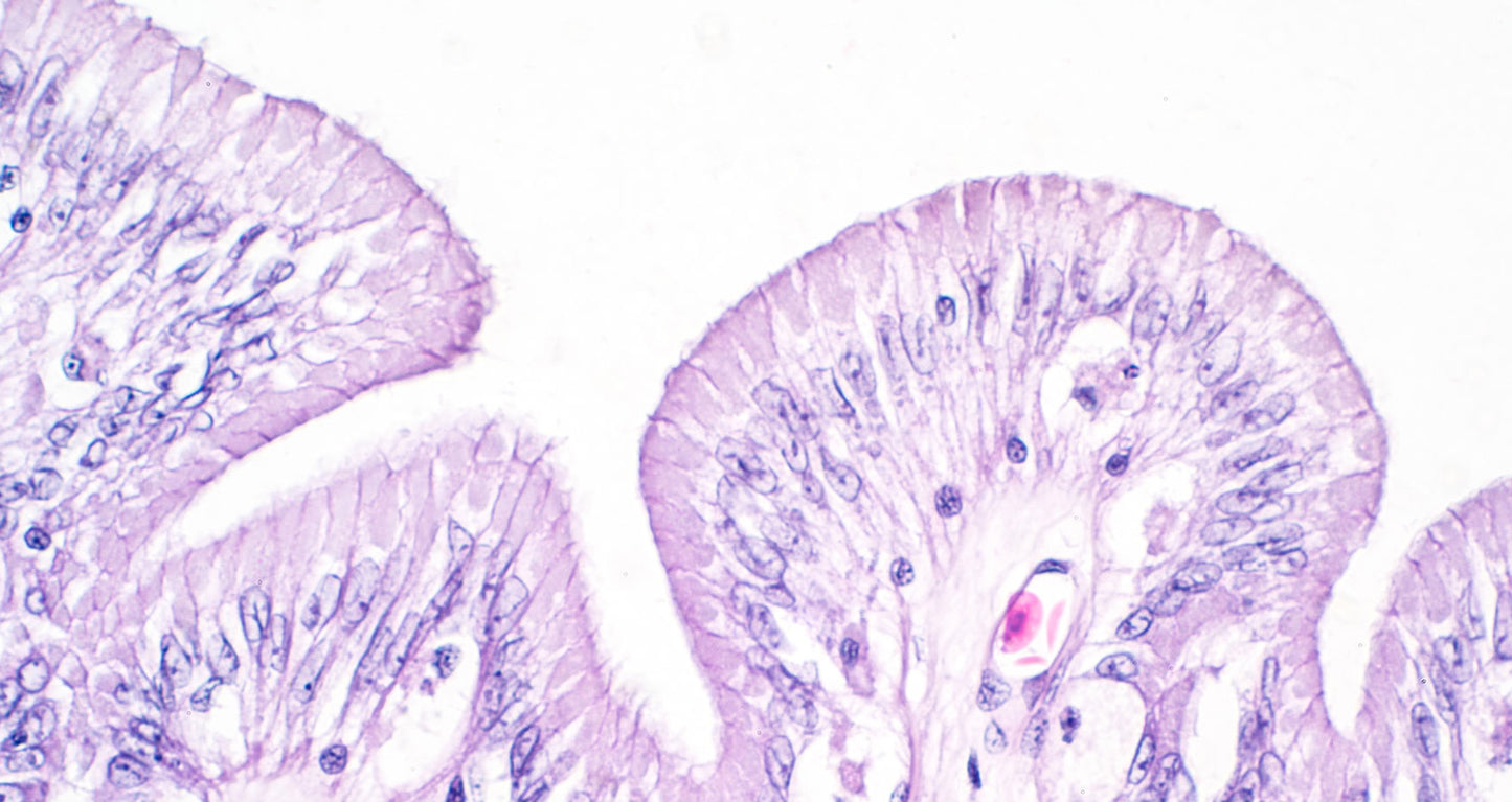 Large intestine tissue under microscope