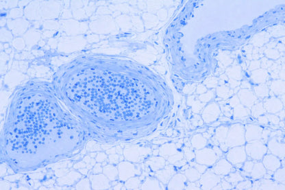 TRANSIL Equilibrium Shift Assay