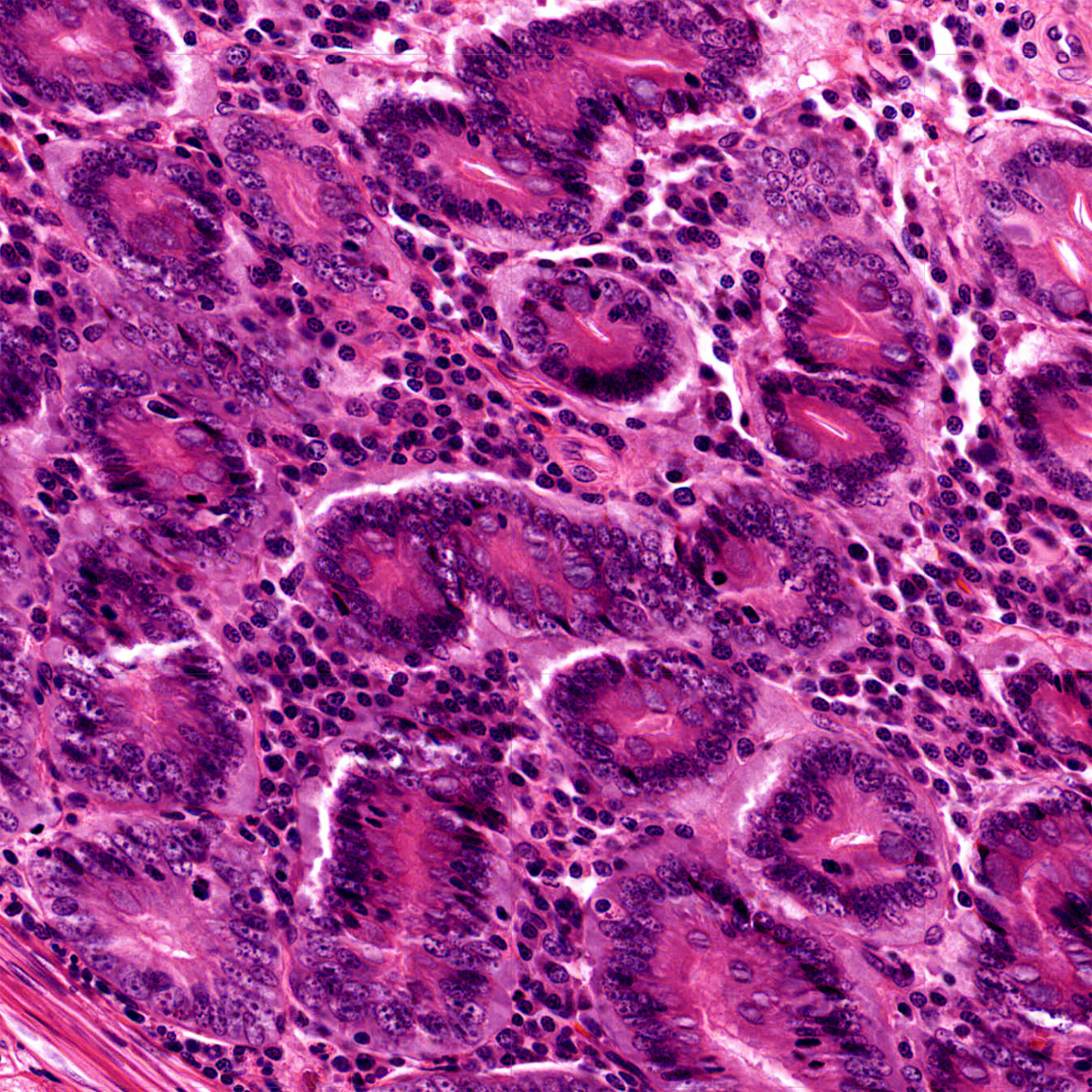 TRANSIL Intracellular Binding Kit