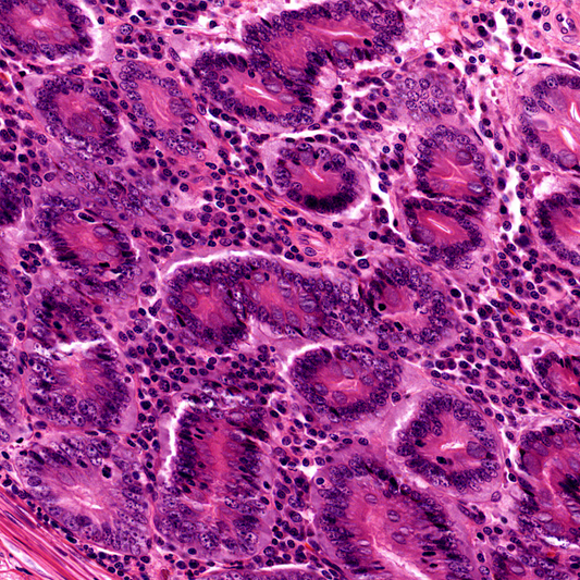 TRANSIL Intracellular Binding Kit