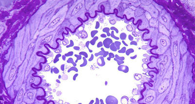 Cross-section of artery illustration